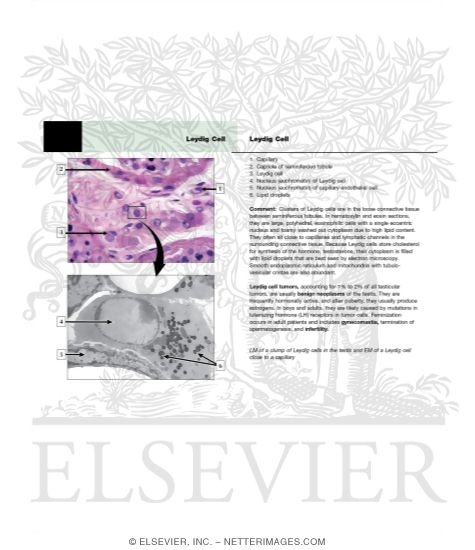 Watermarked preview of unlabeled image: Epididymis