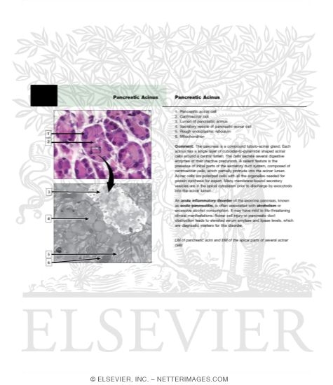 Watermarked preview of unlabeled image: Pnacreatic Acinus
