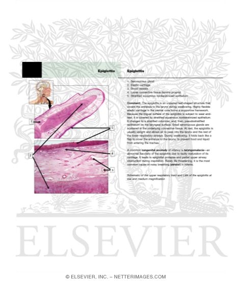 Watermarked preview of unlabeled image: Epiglottis