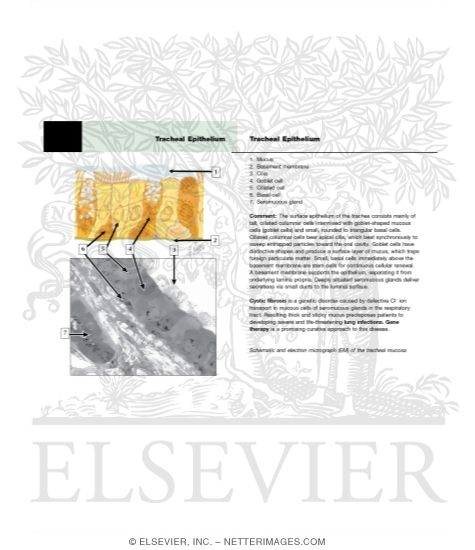 Watermarked preview of unlabeled image: Tracheal Epithelium