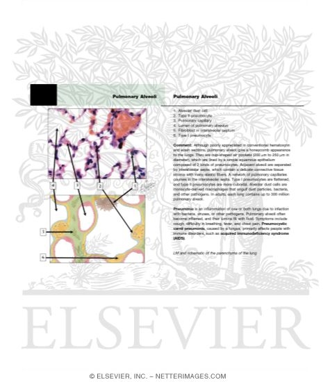 Watermarked preview of unlabeled image: Pulmonary Alveoli