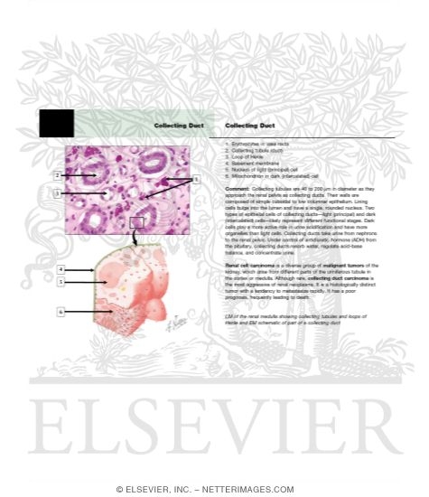 Watermarked preview of unlabeled image: Collecting Duct