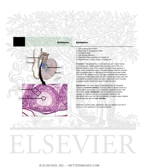 Watermarked preview of labeled image: Light Micrograph of a Clump of Leydig Cells