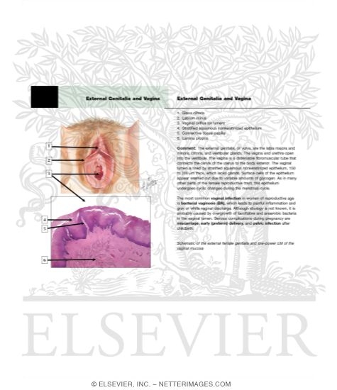 Watermarked preview of unlabeled image: External Genitalia and Vagina