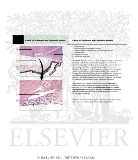 Watermarked preview of unlabeled image: Canal of Schlemm and Aqueous Humor