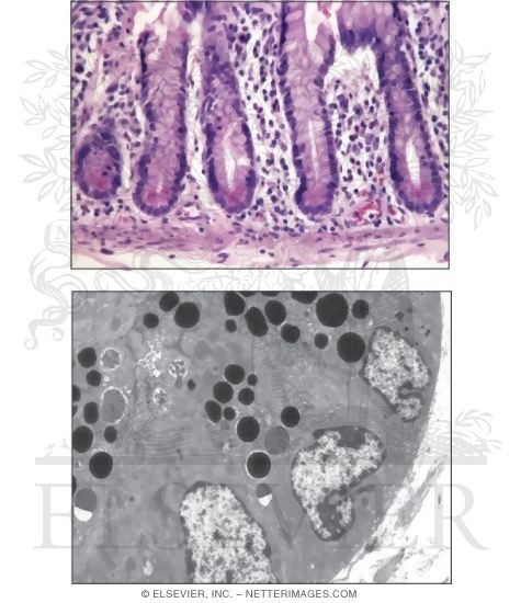 Paneth Cells
