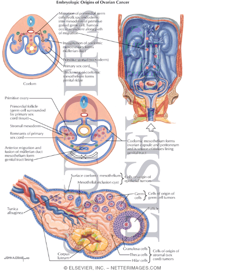 embryologic origins of ovarian cancer