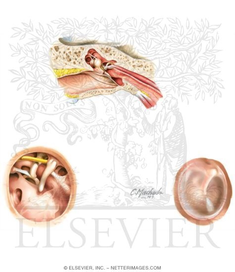 Watermarked preview of unlabeled image: External Ear and Tympanic Cavity