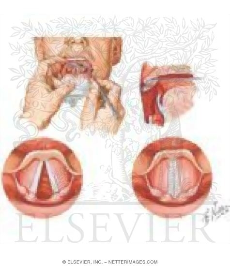 Larynx In Abduction and Adduction