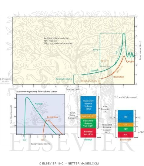 Restrictive Lung Disease Physiology