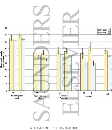 Watermarked preview of labeled image: Estimated Percentage of U.S. Adults With Hypertension By Sex, Race, and Ethnicity, 1999 to 2000