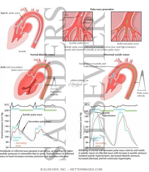 Watermarked preview of labeled image: Wave Reflection and Isolated Systolic Hypertension
