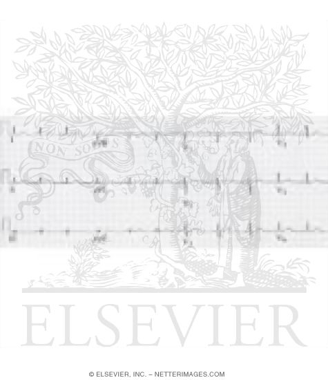 Watermarked preview of unlabeled image: Normal Electrocardiograph