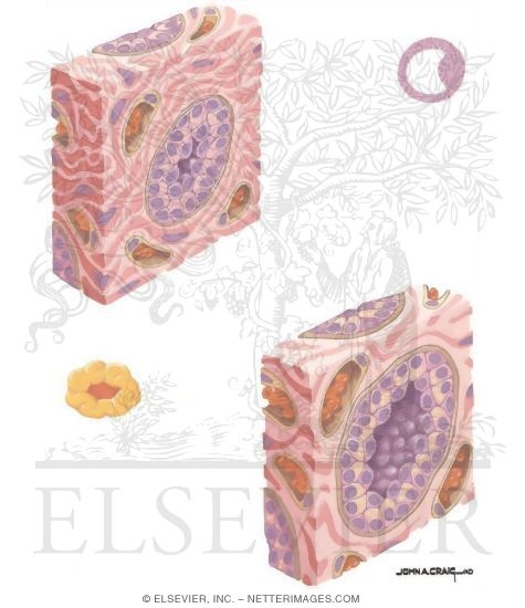 Watermarked preview of unlabeled image: Breast Tumors: Physiology of the Breast