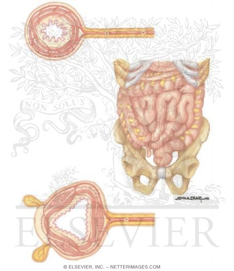 Watermarked preview of unlabeled image: Types of Stomas: Anatomy and Physiology of the Bowel