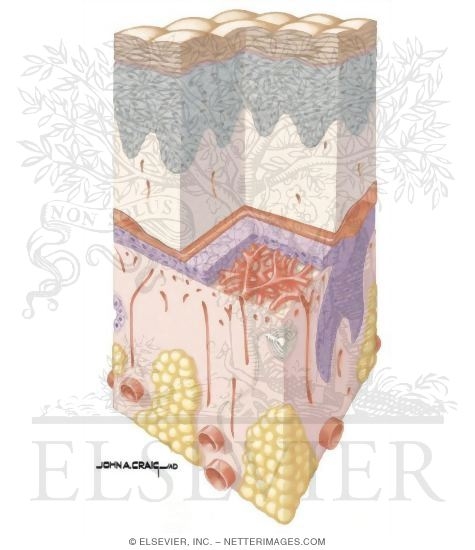 Watermarked preview of unlabeled image: Burn Wound Healing With Xenograft Used As Biologic Dressing