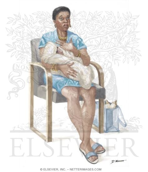 Watermarked preview of unlabeled image: Postpartum Depression