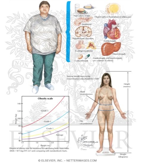 Watermarked preview of labeled image: Obesity