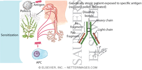 Rhinitis: Allergic and Idiopathic