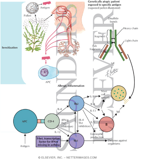 Extrinsic Asthma
