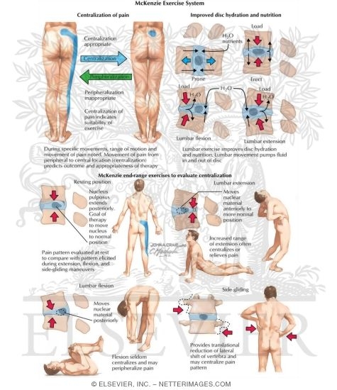 McKenzie Exercise System