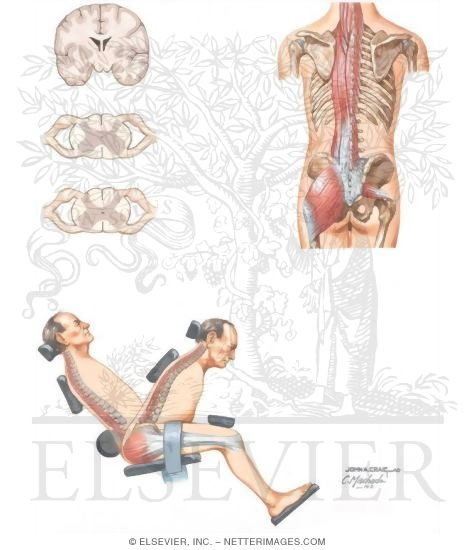 Watermarked preview of unlabeled image: Guided Exercises for Low Back Pain Using Equipment