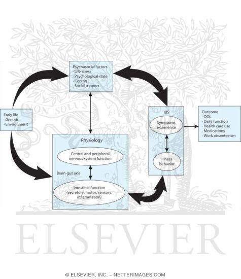 Watermarked preview of unlabeled image: Irritable Bowel Syndrome: Brain-gut Axis