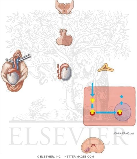 Watermarked preview of unlabeled image: Androgen Deprivation In Metastatic Disease