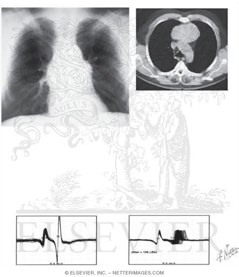Watermarked preview of unlabeled image: Complementary Exams for Neurologic Disorders