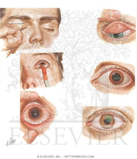 Watermarked preview of unlabeled image: Diagnostic Approach to Ocular Diseases
