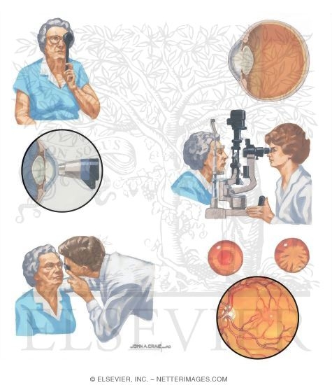 Diagnostic Evaluation In Cataracts