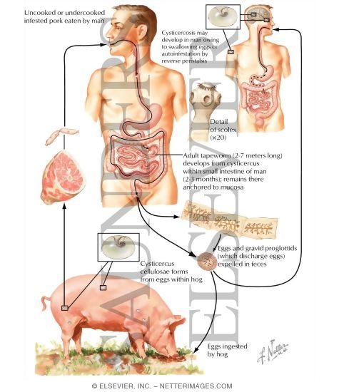 Watermarked preview of labeled image: Parasitic Diseases VII - Taeniasis Solium (Cysticercosis Cellulosae)