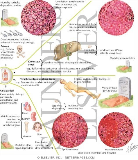 Watermarked preview of labeled image: Drug-Induced Hepatic Injuries