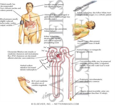Renal Failure in Liver Disease