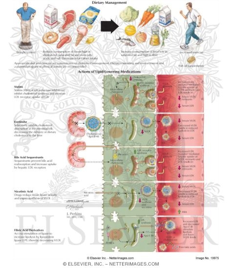Watermarked preview of labeled image: Hypercholesterolemia: General Management Measures