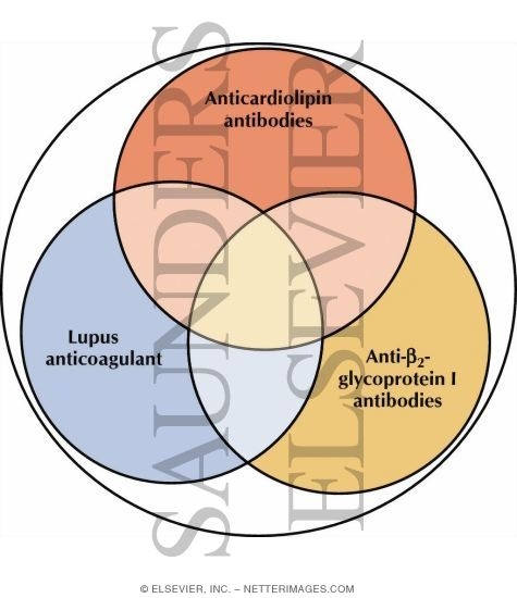 Watermarked preview of labeled image: Antiphospholipid Antibodies
