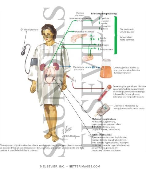 Watermarked preview of labeled image: Diabetes In Pregnancy