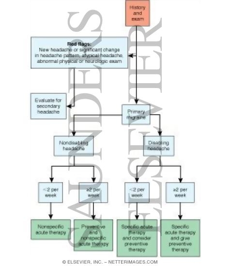 Watermarked preview of labeled image: Approach to Migraine Treatment