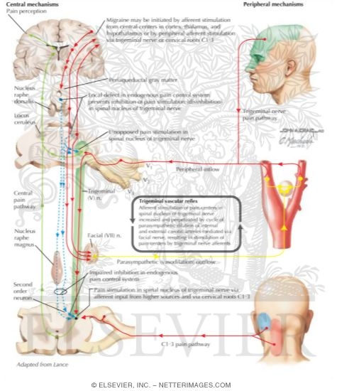 Watermarked preview of labeled image: Mechanisms in Migraine