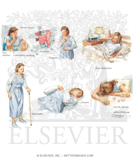 Watermarked preview of labeled image: Signs Suggestive of Alcohol Abuse
