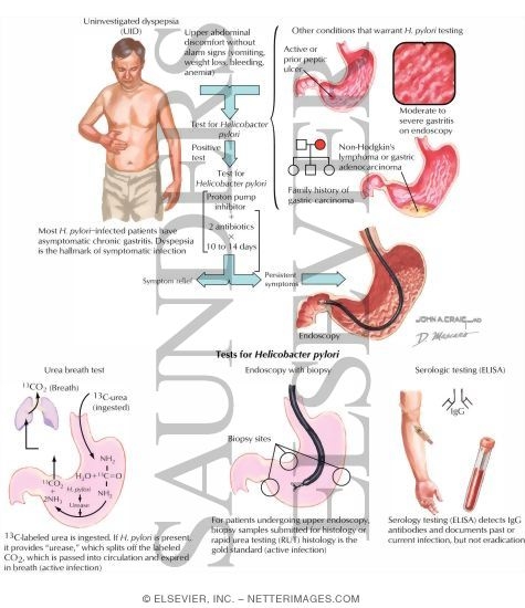Watermarked preview of labeled image: Diagnosis and Management of Helicobacter Pylori