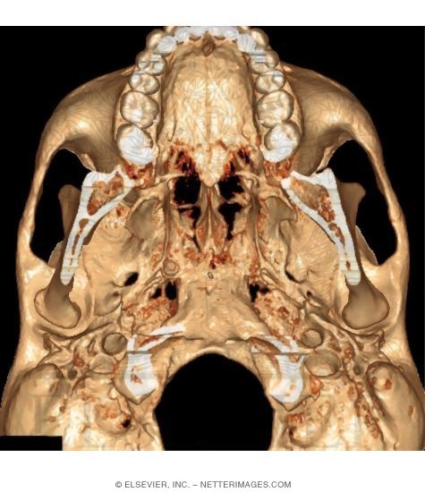 Skull: Basal View