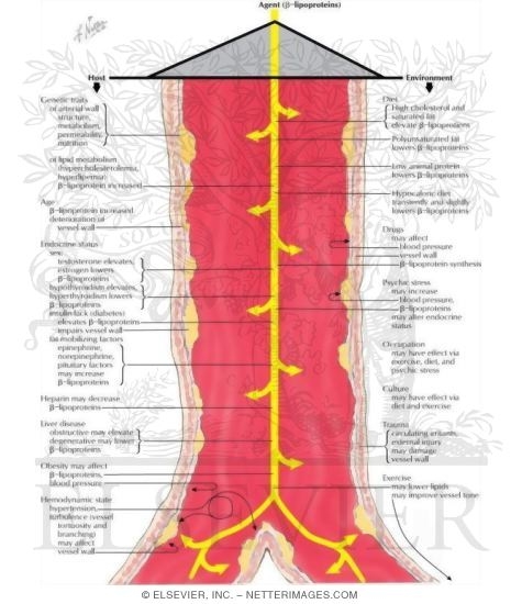Watermarked preview of labeled image: Atherosclerosis