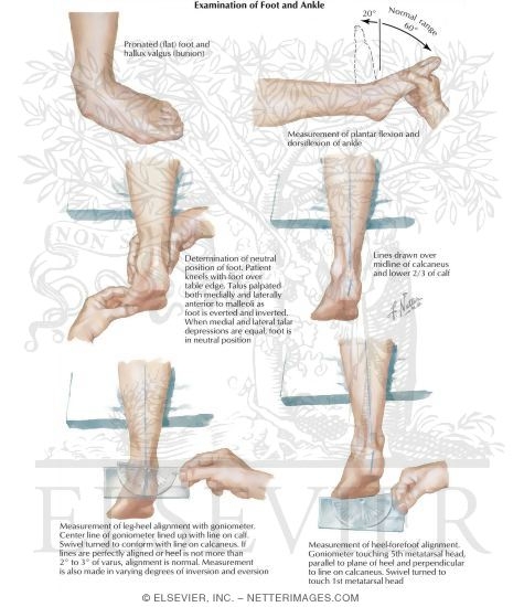 Examination of the Foot and Ankle