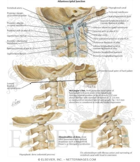 atlanto occipital joint