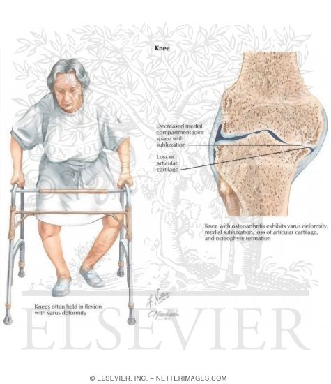 Watermarked preview of labeled image: Knee
