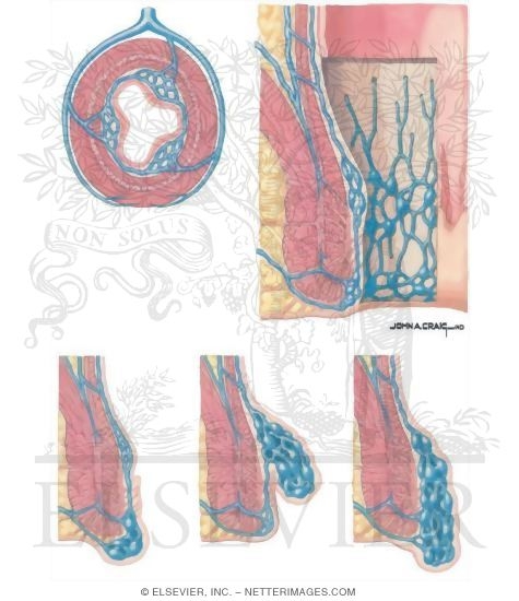 download red flags a guide to identifying serious pathology of the spine physiotherapy pocketbooks