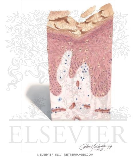 Watermarked preview of unlabeled image: Skin