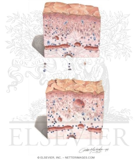 Watermarked preview of unlabeled image: Eosinophil and Macrophage