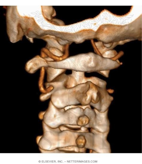 Vertebral Artery, Atlas